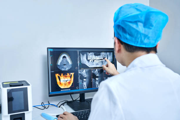 Best Knocked-Out Tooth Emergency  in Bridge City, TX