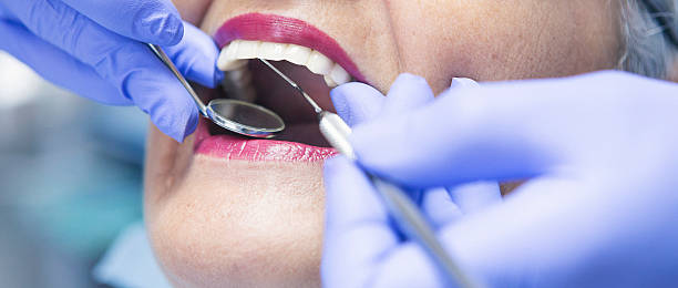 Best Dentist for Tooth Abscess  in Bridge City, TX